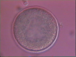 1 cell zygote